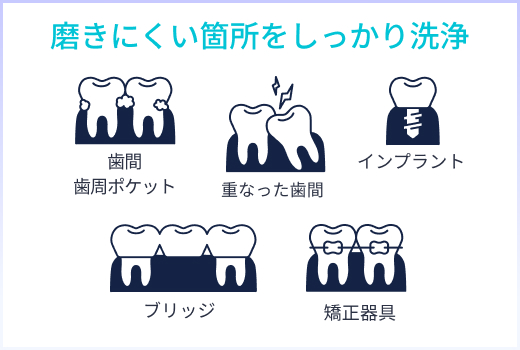 美ルル トゥースクリーン